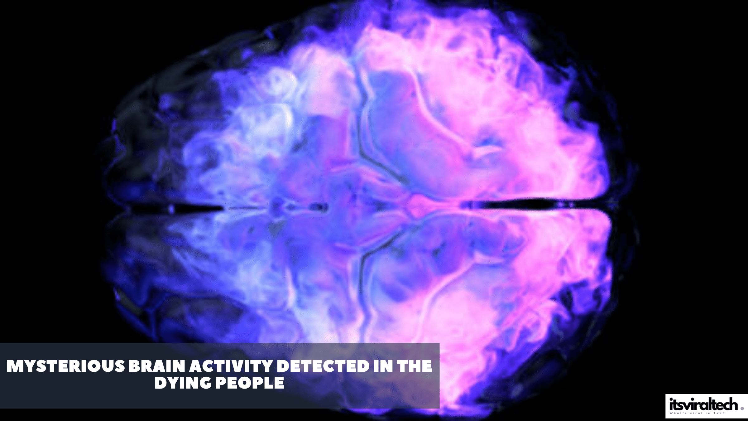 Science Research: मरने वाले लोगों के दिमाग में रहस्यमय गतिविधि का पता चला